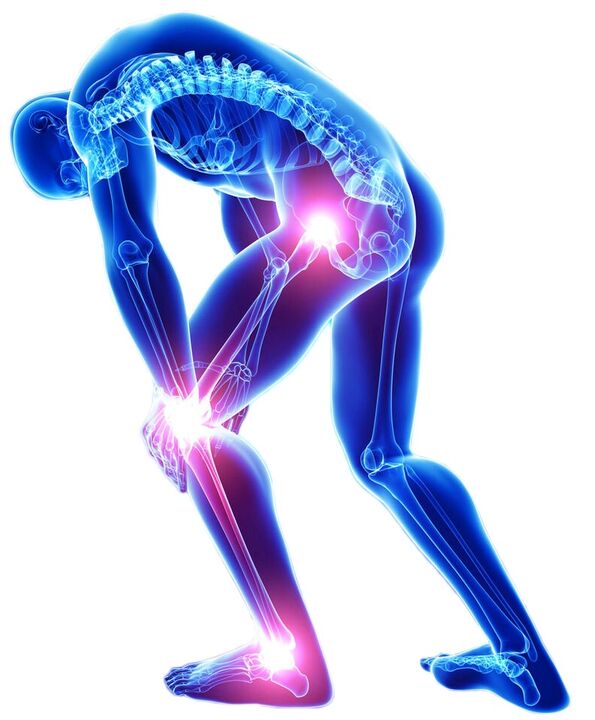 Сильная боль при движении - симптом заболевания суставов. 
