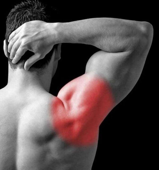 Боль в плече и затылке, вызванная шейным остеохондрозом